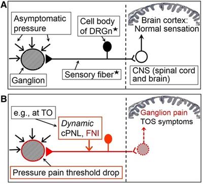 Frontiers | Chronic Pain And Local Pain In Usually Painless Conditions ...